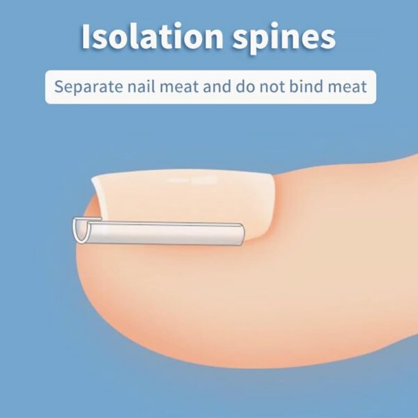40 Pcs Toenail Correction Patch,Ingrown Toenail Corrector Set,Pain-Free Toenail Straightener Strips with Toenail Lifter,Toenail Correction for Ingrown Toenails for Women Men Foot Care