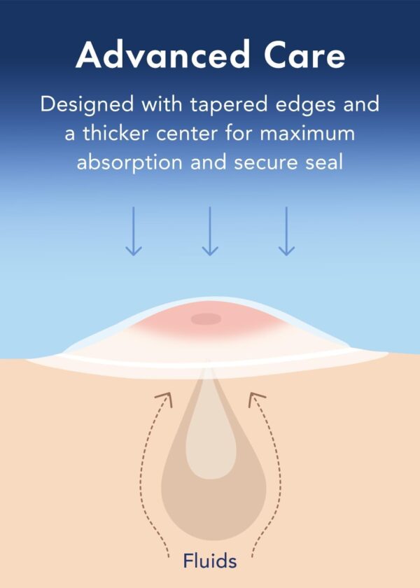 Rael Pimple Patches, Miracle Retinol Spot Cover - Korean Skincare, Hydrocolloid, Acne Spot Treatment Patch, Face Stickers, PM Advanced Treatment, Vegan & Cruelty Free (72 count)