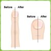 VYTALIVING BioClear Nail Doctor - Ingrown Toenail Treatment - Fungal Nail Treatment for Toenail – Aids in Toe Nail Care | 15 ml