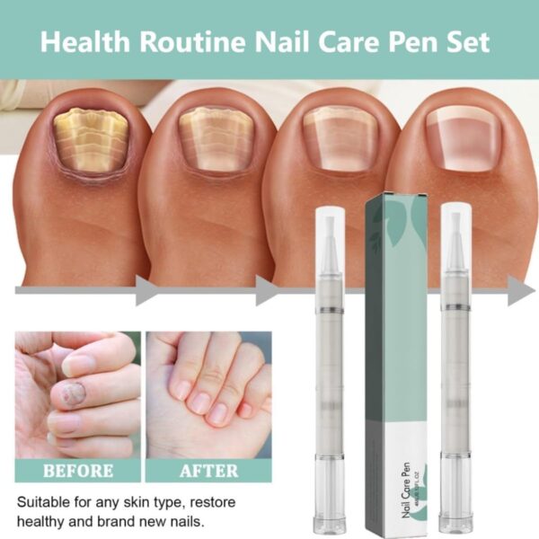 KARLOR Nail Care Pencil Set - 2 Piece Nail Fungus Pen Set for Toenails and Fingernails
