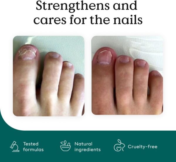HealthRoutine Nail Care Pen – The Original from Austria with Tea Tree Oil and Vitamin E, Nail Oil Nail Strengthener and Nail Hardener for Damaged Nails, 4ml