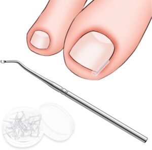 40 Pcs Toenail Correction Patch,Ingrown Toenail Corrector Set,Pain-Free Toenail Straightener Strips with Toenail Lifter,Toenail Correction for Ingrown Toenails for Women Men Foot Care