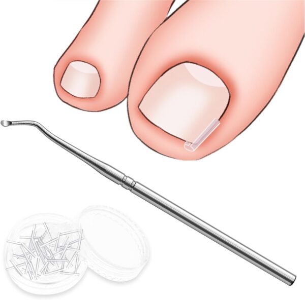 40 Pcs Toenail Correction Patch,Ingrown Toenail Corrector Set,Pain-Free Toenail Straightener Strips with Toenail Lifter,Toenail Correction for Ingrown Toenails for Women Men Foot Care