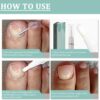 Fungal Nail Treatment Pen for Toenails and Fingernails,Fungal Nail Serum Pen,Toenail Fungus Treatment Pen,Nail Fungal Liquid,Fungal Nail Relieve,Anti Fungus Nail Repair,Improve Damaged Nails