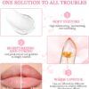 LOPHE Clear Flower Jelly Lipstick, 3Pcs Magic Temperature Color Change Lip Balm, Long Lasting Moisturizing Lip Gloss Set, Nutritious Crystal Lip Stick Makeup Set, Great Gift for Women and Girl