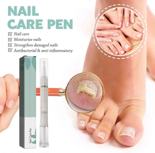 2 PCS Nail Care Pen, Nail Growth Serum, Nail Treatment Pen, Cuticle Oil For Nails, Nail Growth Treatment Pen, Nail Growth Treatment Nourishment Cuticles, Foot Care Nail Repair Pen