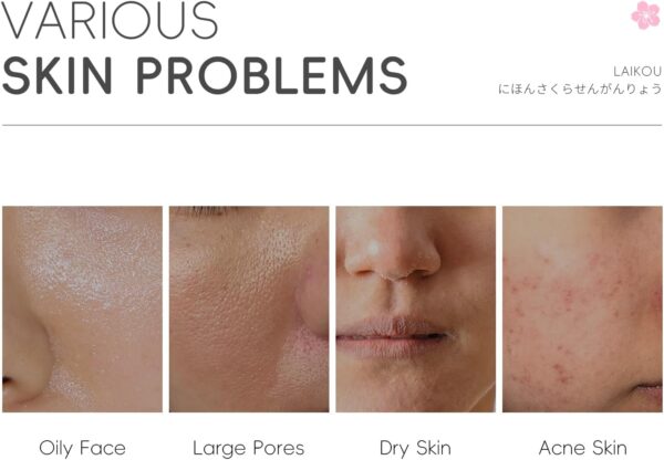 61H8LeMh6BL._AC_SL1500_.jpg LAIKOU Skin Care for Teenage Girls, Sakura Skincare Set, Pamper Sets for Women Gifts, Facial Skin Care Sets & Kits - Toner,Cleanser,Face Serum,Cream,Sleep Mask,Eye Mask,Mud Mask,Lip Mask, 24PCS