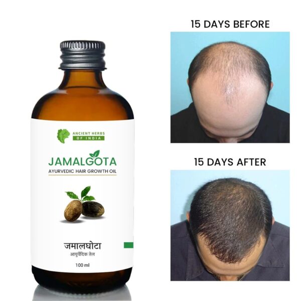 Jamalgota Ayurvedic Hair Growth Oil for Women & Men | Promotes New Hair Growth & Strengthens Hair | With Amla, Camphor Coconut and Bhringraj Oil | Nourishes Scalp & Controls Hair Fall