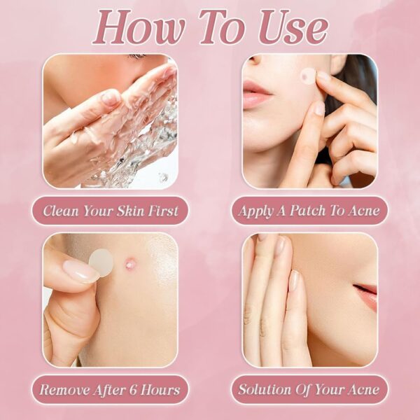 Pimple Patches Pack Of 120 Hydrocolloid Spot Patches Fast-Acting Salicylic Acid Acne Patches Vegan & Cruelty Free Pimple Patch Clear Spot Stickers for Face