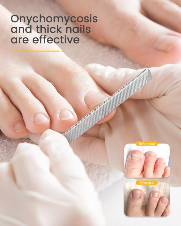 BEZOX Long Steel Nail File for Onychomycosis, Ingrown Nail，Thick and Fungal Nails with Dual-Ended Toenail Lifter – The Ultimate Manicure & Pedicure Tool for Men and Women’s Nail Care