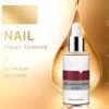 Nail Care Essence - Fingernail & Toenail Care Solution