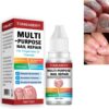 AINxtolm Fungal Nail Treatment,Nail Fungus Treatment Toenail,Toe Nail,Toenail Fungus Treatment,Fungal Nail Treatment Toenails Extra Strong,Fingernail Toenail Care Nail Repair, red, 10 millilitre