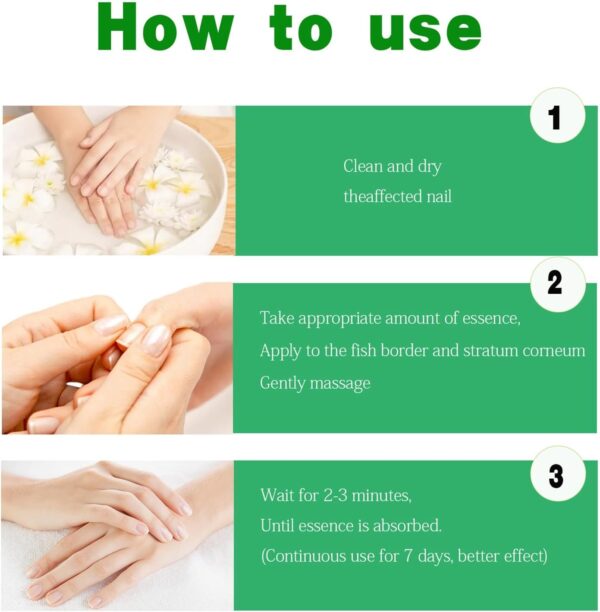 Ginger Nail Treatment Nail Support Nail Care - Ginger Nail Growth Serum, 7 Days Nail Treatment, Ginger Cuticle Care Oil for Nails, Nail Strengthener For Damaged Nails, Fungal Nail Treatment