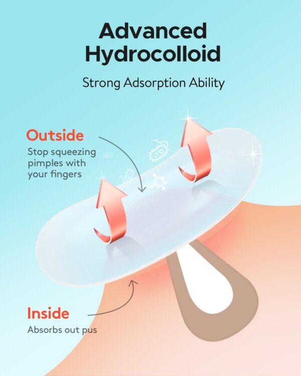 61XYfUNr0L._AC_SL1500_.jpg LitBear 84 Patches 5 Size Acne Patches Large, Hydrocolloid Pimple Patches for Large Breakouts, Zit and Blemish, Large Acne Patches for Face, Chin, Back and Body with Tea Tree Oil