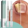 KARLOR Nail Care Pencil Set - 2 Piece Nail Fungus Pen Set for Toenails and Fingernails