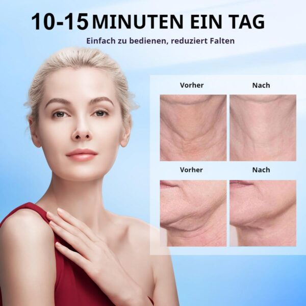 Face Massager, Demine Face Lifting Device, Wrinkle Remover with Heating and Cold Compresses, for Skin Care, Improves, Firms, Tightens
