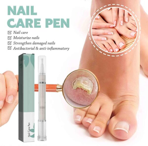 Fungal Nail Treatment Pen for Toenails and Fingernails,Fungal Nail Serum Pen,Toenail Fungus Treatment Pen,Nail Fungal Liquid,Fungal Nail Relieve,Anti Fungus Nail Repair,Improve Damaged Nails
