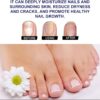 7 Days Nail Fungus Treatment Toenail Fungus Treatment Extra Strength-Ginger Nail Treatment,Toenail Cuticle Care Oil Care,Multi-Purpose Nail Repair for Your nails a Natural Shine (1)
