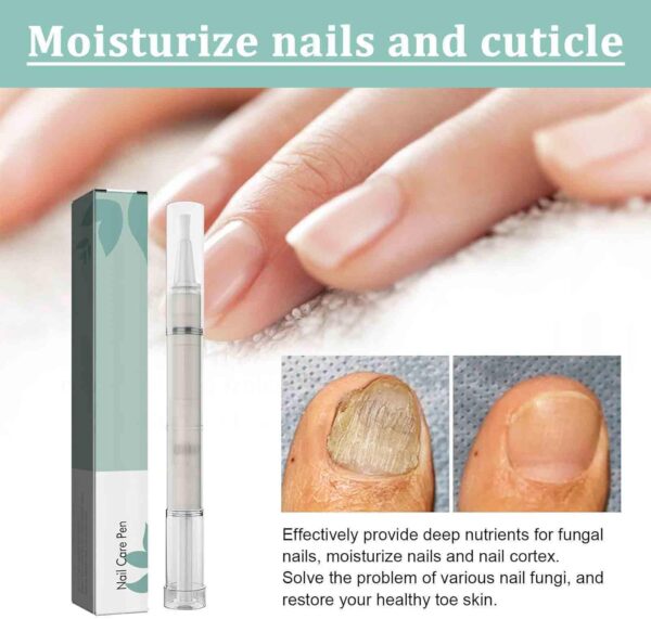 2 PCS Nail Care Pen, Nail Growth Serum, Nail Treatment Pen, Cuticle Oil For Nails, Nail Growth Treatment Pen, Nail Growth Treatment Nourishment Cuticles, Foot Care Nail Repair Pen