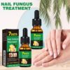 Ginger Nail Treatment Nail Support Nail Care,Fungal Nail Treatment,Ginger N/ail Growth Treatment Serum,7 D/ays Na/il Treatment,Na/il Strengthener for Damaged Nails,Nai/l Hardener,Nai/l Repair