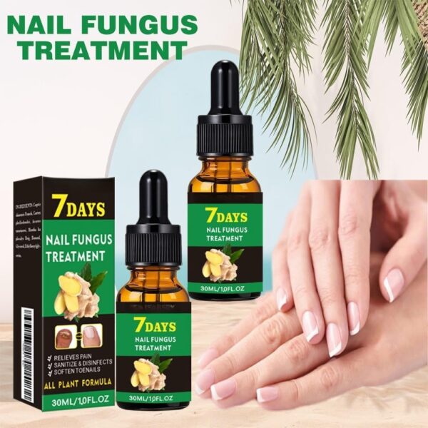 Ginger Nail Treatment Nail Support Nail Care,Fungal Nail Treatment,Ginger N/ail Growth Treatment Serum,7 D/ays Na/il Treatment,Na/il Strengthener for Damaged Nails,Nai/l Hardener,Nai/l Repair