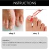 Ingrown Toenail Treatment - 30ml Ingrown Toenail - Cuticle Care Oils for Ingrown Toenails - Trimming Toenail Softening Drops Natural Ingrown Toenail Correction Treatment Fungal Nail Treatment