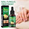 Nail Fungus Treatment, Ginger Nail Fungus Treatment,Toenail Cuticle Care Oil Care, Multi-Purpose Nail Repair for Your nails a Natural Shine (2 Pcs)