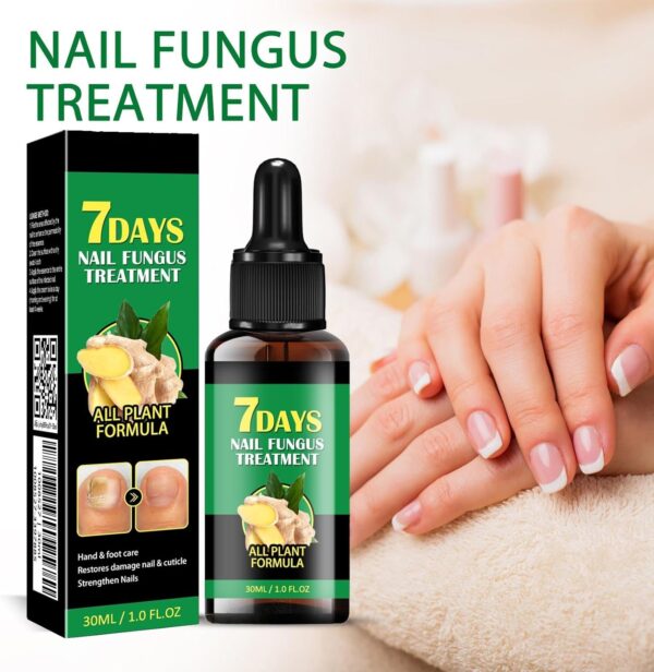Nail Fungus Treatment, Ginger Nail Fungus Treatment,Toenail Cuticle Care Oil Care, Multi-Purpose Nail Repair for Your nails a Natural Shine (2 Pcs)