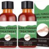 Nail Fungus Treatment For Toenail - Extra Strong Fungal Nail Treatment - Anti fungus Nail Repair and Strengthen, Fix & Renew Damaged, Broken Nails （2PC）