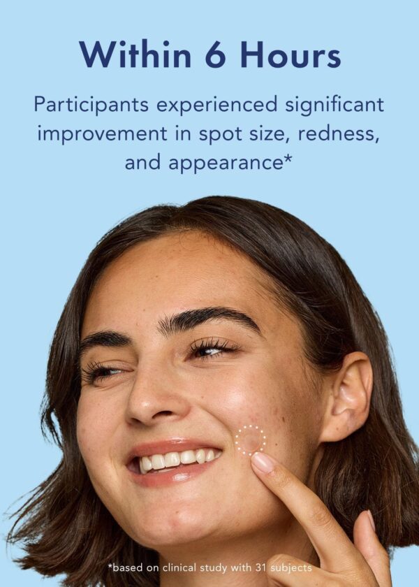 Rael Pimple Patches, Miracle Retinol Spot Cover - Korean Skincare, Hydrocolloid, Acne Spot Treatment Patch, Face Stickers, PM Advanced Treatment, Vegan & Cruelty Free (72 count)