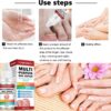AINxtolm Fungal Nail Treatment,Nail Fungus Treatment Toenail,Toe Nail,Toenail Fungus Treatment,Fungal Nail Treatment Toenails Extra Strong,Fingernail Toenail Care Nail Repair, red, 10 millilitre