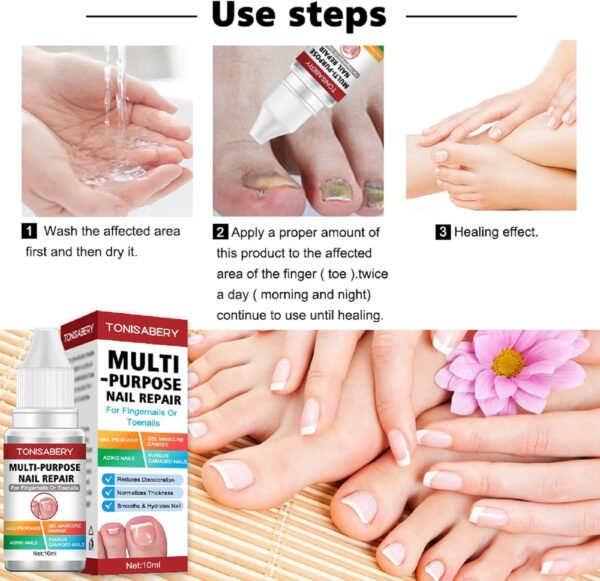 AINxtolm Fungal Nail Treatment,Nail Fungus Treatment Toenail,Toe Nail,Toenail Fungus Treatment,Fungal Nail Treatment Toenails Extra Strong,Fingernail Toenail Care Nail Repair, red, 10 millilitre