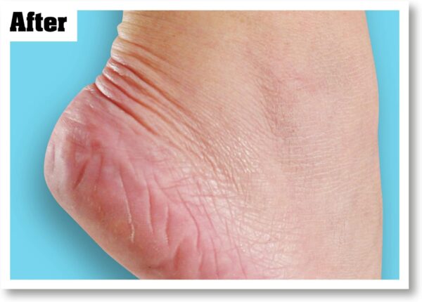 711brNJ83fL._AC_SL1500_.jpg O'Keeffe's Healthy Feet, 91g, Packaging may vary