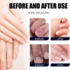 7 Days Nail Fungus Treatment Toenail Fungus Treatment Extra Strength-Ginger Nail Treatment,Toenail Cuticle Care Oil Care,Multi-Purpose Nail Repair for Your nails a Natural Shine (1)