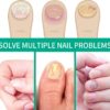 2PCS Fungal Nail Treatment Pen for Toenails and Fingernails,Nail Fungus Treatment for Toenail,Anti Fungal Nail Treatment,toe nail fungal treatment,nail repair essence,Anti Fungus Nail Strengthener