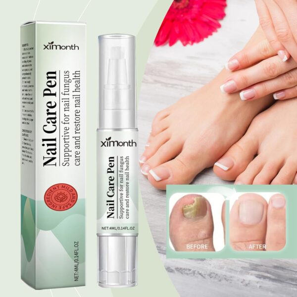 2PCS Fungal Nail Treatment Pen for Toenails and Fingernails,Nail Fungus Treatment for Toenail,Anti Fungal Nail Treatment,toe nail fungal treatment,nail repair essence,Anti Fungus Nail Strengthener