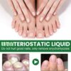 Ginger Nail Treatment Nail Support Nail Care,Fungal Nail Treatment,Ginger N/ail Growth Treatment Serum,7 D/ays Na/il Treatment,Na/il Strengthener for Damaged Nails,Nai/l Hardener,Nai/l Repair
