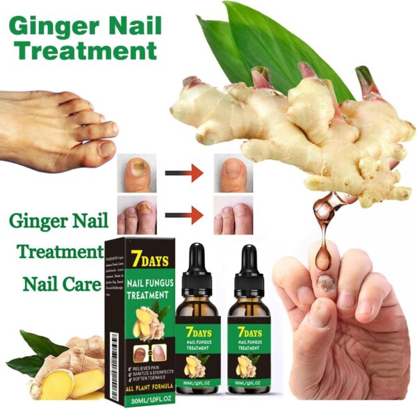Ginger Nail Treatment Nail Support Nail Care - Ginger Nail Growth Serum, 7 Days Nail Treatment, Ginger Cuticle Care Oil for Nails, Nail Strengthener For Damaged Nails, Fungal Nail Treatment