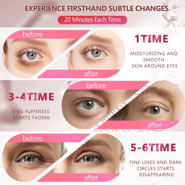 2 Packs 60 Pcs Under Eye Patches, 24K Gold+Pink, 30 Pairs Women Undereye Mask for Puffy Eyes Dark Circles Treatment, Beauty Skin Care, Men Collagen Gel Pads Hydrating for Eye Bags Puffiness Wrinkle