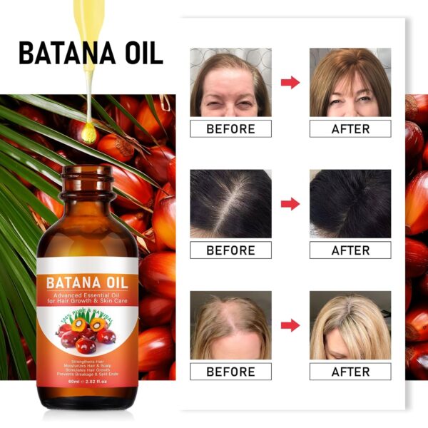 Batana Oil for Hair Growth, 100% Pure Natural Raw Batana Oil for Hair Growth, Prevent Hair Loss, Eliminate Hair Split Ends, Promotes Hair Thickness for Men & Women-2.02 fl oz