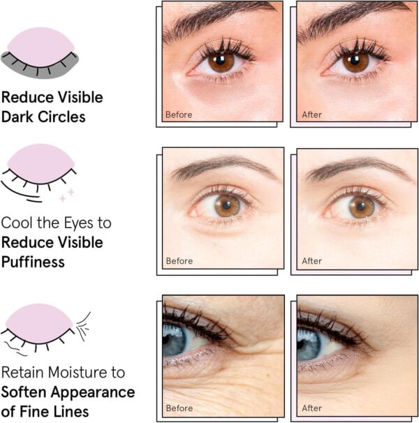 Under Eye Mask - Reduce Dark Circles, Puffy Eyes, Undereye Bags, Wrinkles - Gel Under Eye Patches, Vegan Cruelty-Free Self Care by grace and stella (24 Pairs, Gold)