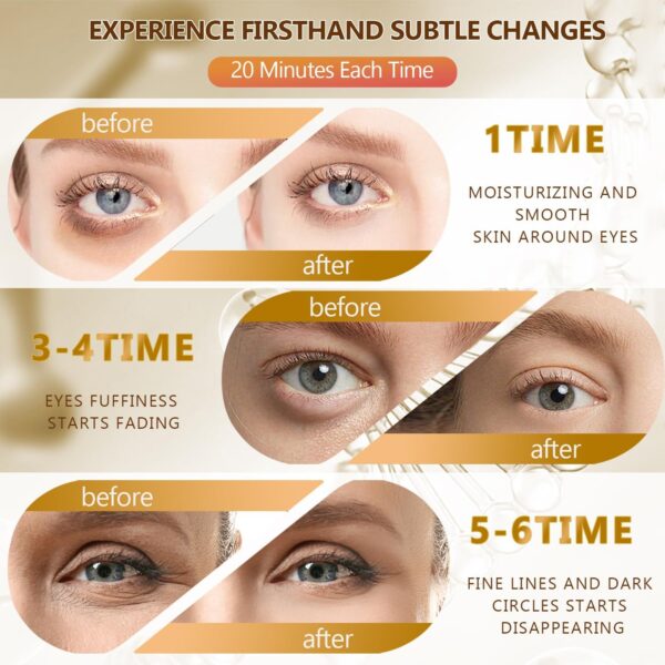 60 Pcs 24K Gold Under Eye Patches, 30 Pairs Women Undereye Mask for Puffy Eyes Dark Circles Treatment, Beauty Skin Care Products, Men Collagen Gel Pads Hydrating for Eye Bags Puffiness Wrinkle