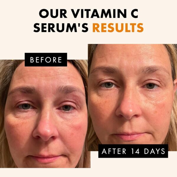 Vitamin C Face Serum - Hyaluronic Acid, Retinol, & Vit E - Anti Aging Facial Brightening Serum for Skin Care - Timeless Pure Vitamin C Serum for Face Dark Spots, Vit C Serum Oil, Face Serum for Women