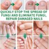 Nail Fungus Treatment, Ginger Nail Fungus Treatment,Toenail Cuticle Care Oil Care, Multi-Purpose Nail Repair for Your nails a Natural Shine (2 Pcs)
