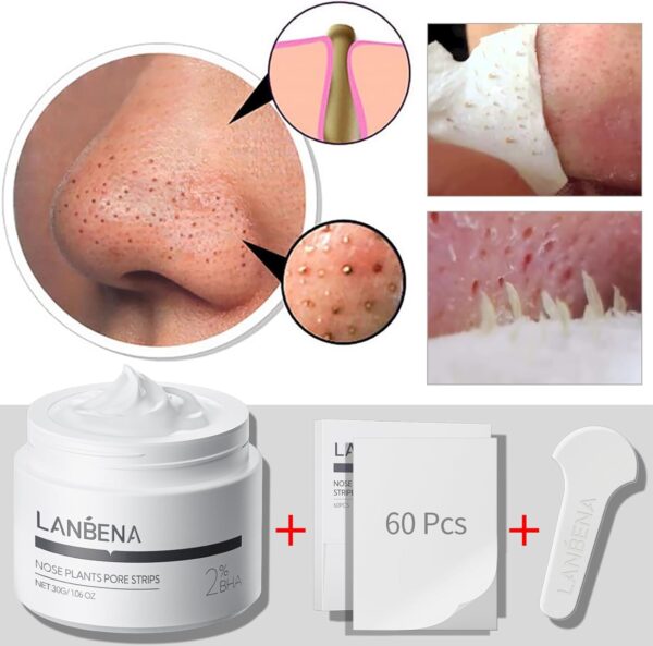 LANBENA Blackhead Mask (30g), 60 Pieces Nose Pore Strips, Note: Cream Goes Dry out/Gunk below 25 Degrees, Place Bottle in Boiling Water to Soften