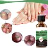Nail Fungus Treatment For Toenail - Extra Strong Fungal Nail Treatment - Anti fungus Nail Repair and Strengthen, Fix & Renew Damaged, Broken Nails （2PC）