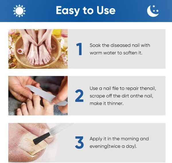 JORUN 2 Pcs Fungal Nail Treatment for Toenails Extra Strong Nail Care Serum - Natural 60 Ml Toe Nail Fungal Treatment - No Stimulation Nail Growth Treatment for Broken,Discolored Fungal Nail
