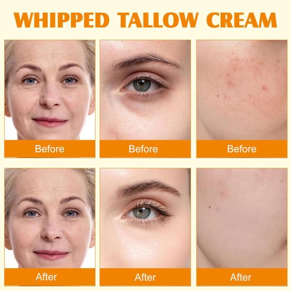Beef Tallow for Skin,Meifenla Tallow and Honey Cream Natural Tallow Face Moisturizer, Organic Hydrating Beef Tallow Balm Deeply Moisturizing for Face & Body Skin Care