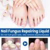 JORUN 2 Pcs Fungal Nail Treatment for Toenails Extra Strong Nail Care Serum - Natural 60 Ml Toe Nail Fungal Treatment - No Stimulation Nail Growth Treatment for Broken,Discolored Fungal Nail