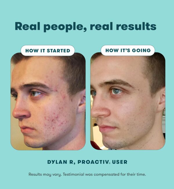 71ECD-bXKIL._AC_SL1500_.jpg Proactiv Solution 60 Day Facial Cleansing 3-Step Routine, 1 x Cleanser 120 ml, 1 x Facial Toner 120 ml, 1 x Hydrator 60 ml (Pack of 1)
